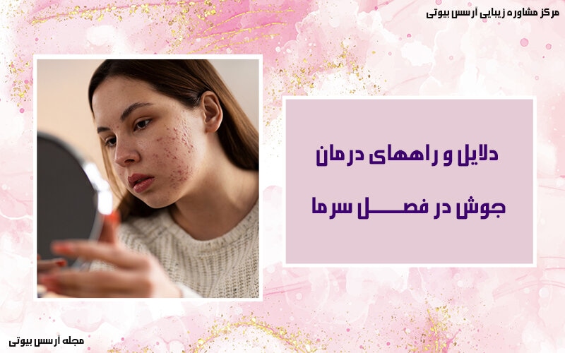دلایل و درمان جوش در فصل سرما