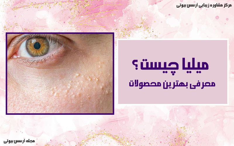 همه چیز درباره میلیا